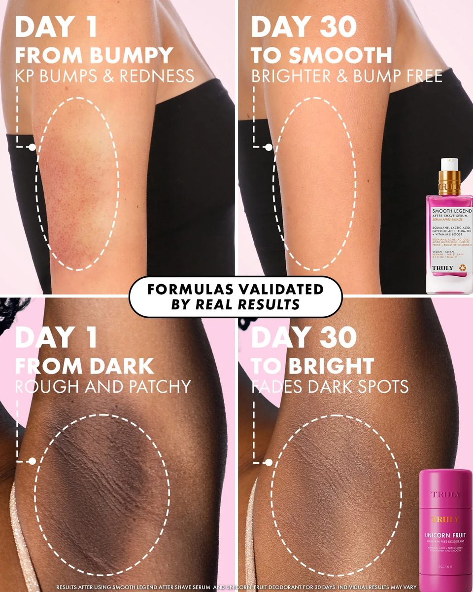 Truly The Viral Edit Vol. 1 Set - Image 7