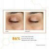 Murad - Suero De Ojos Con Vitamina C Para Ojeras 15ml Tipo De Piel Todo Tipo De Piel - Image 5